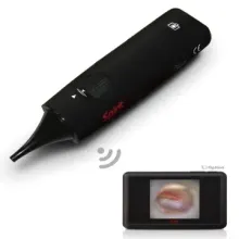 Digital Otoscope